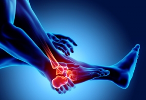 Stress Fractures of the Foot and Ankle