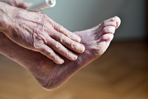 Poor Circulation in Your Feet